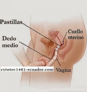 pastillas abortivas en ecuador